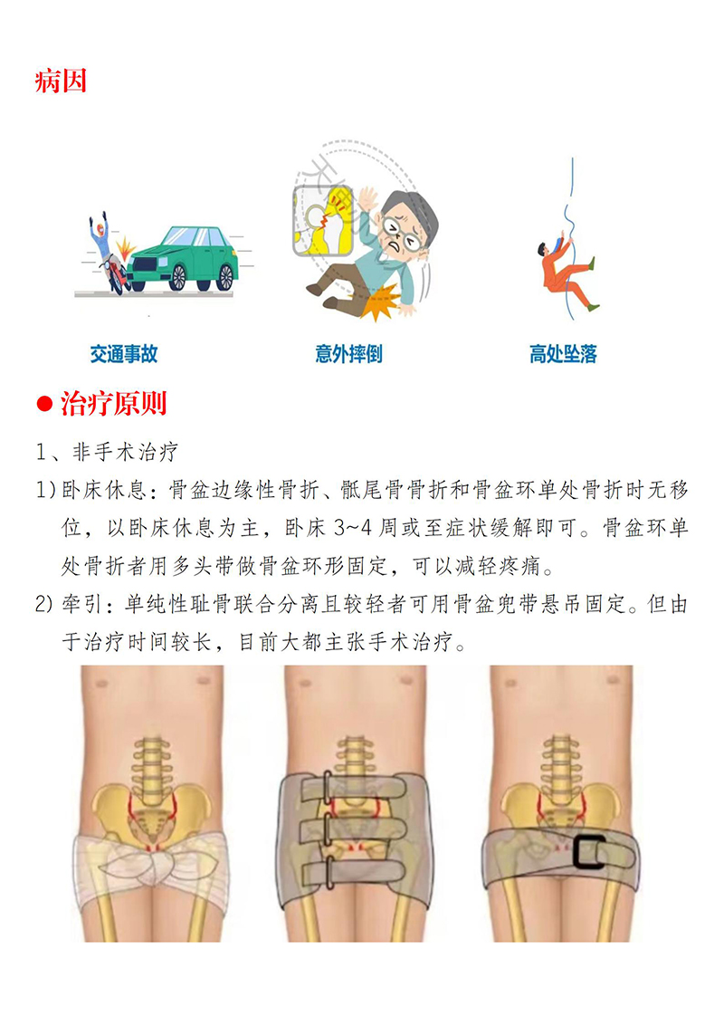 骨盆骨折健康教育_02.jpg