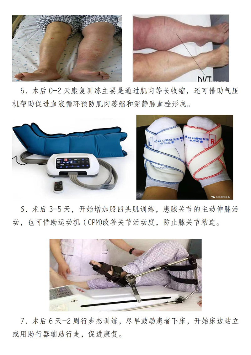 膝关节置换健康教育_04.jpg