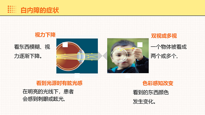 白内障的健康宣教_07.jpg